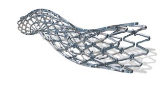 stent