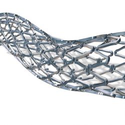 stent stent
