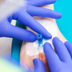 Dr Bertrand Drugeon Cathéters