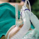 Dr Quentin Saint Genis intubation